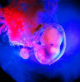 Menschlicher Embryo (6. SSW)