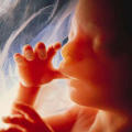 Menschlicher Fetus (18. SSW)