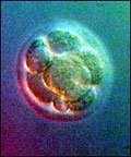 Menschlicher Embryo im Morulastadium (1. SSW)